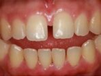 orthodontist gardena ca c5e05a9f6 1